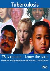 tuberculosis r 1476098010